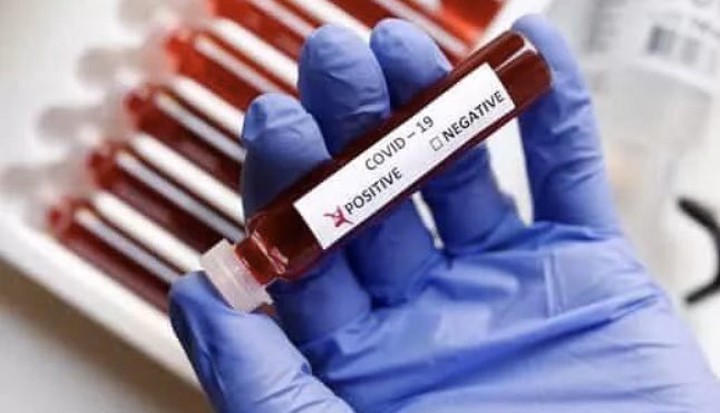 ВОЗ не смогла определить долю населения для развития иммунитета к коронавирусу