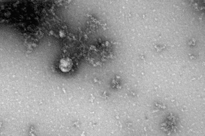В Роспотребнадзоре получили первое изображение британского штамма COVID-19