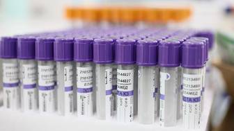 Чем опасен пастереллез