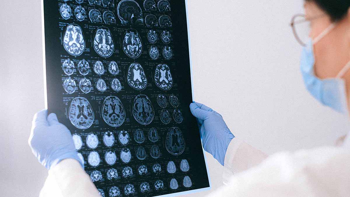 Guardian: Ученому Култхарту запретили исследовать загадочное заболевание мозга