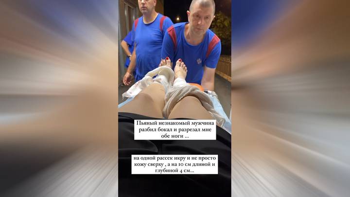 Пьяный мужчина изрезал осколком стекла бьюти-блогера Оксану Левкину