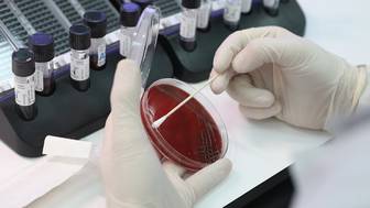 Ученые СПбПУ разработали новую форму лекарств для борьбы с меланомой