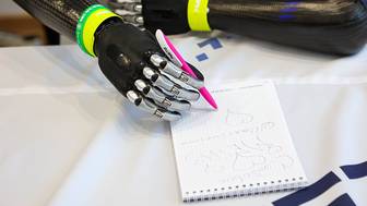 Школьнику, потерявшему пальцы при взрыве СВУ в Красногорске, сделали протез