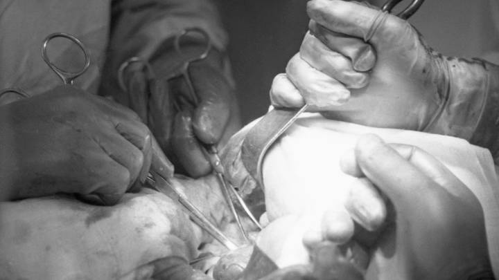 Дело главного уролога СССР Миловидова: как он «превращал» пациентов в инвалидов Дело главного уролога СССР Миловидова: как он «превращал» пациентов в инвалидов