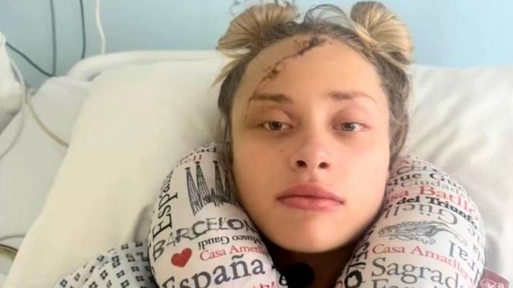Покалеченная в Дубае украинская модель показала шрам на пол-лица