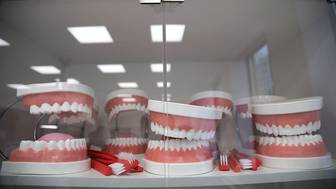 Какие основные признаки нарушения прикуса