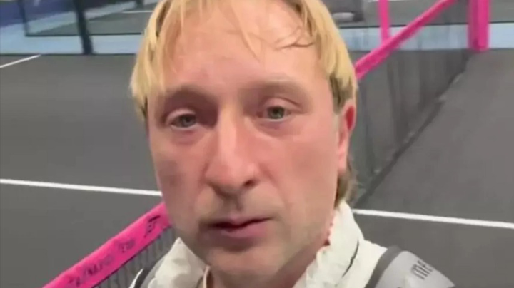 Плющенко показал, как выглядит спустя три месяца после пластики лица