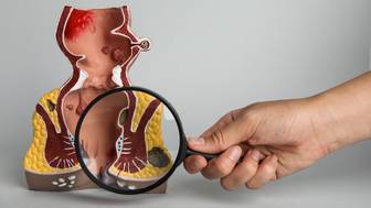 Как часто необходимо проверяться у проктолога; группы риска