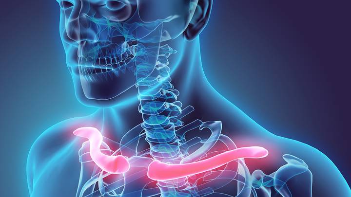 Ключично-черепной дизостоз: что такое синдром Шейтхауэра — Мари — Сентона