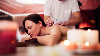 Иглоукалывание: польза и вред для здоровья, помогает ли похудеть