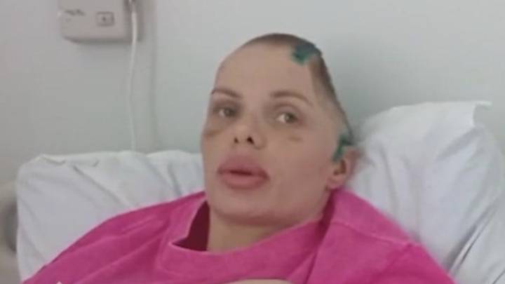 Лишилась половины черепа: избитая модель Анжелика Тартанова вышла из комы