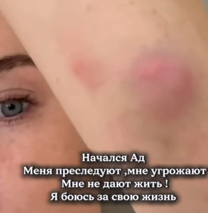 Москвичка обвинила бывшего мужа в сталкинге: версия девушки, позиция мужчины, детали их истории