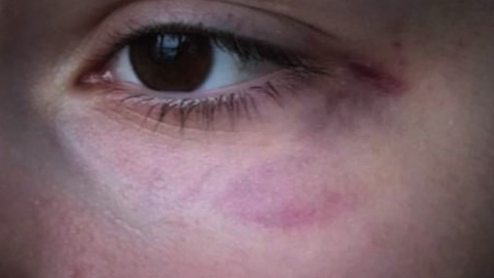 Конфликт Алены Кравец с приемной дочерью: причина, шантаж интимными фото, вымогательство 600 миллионов