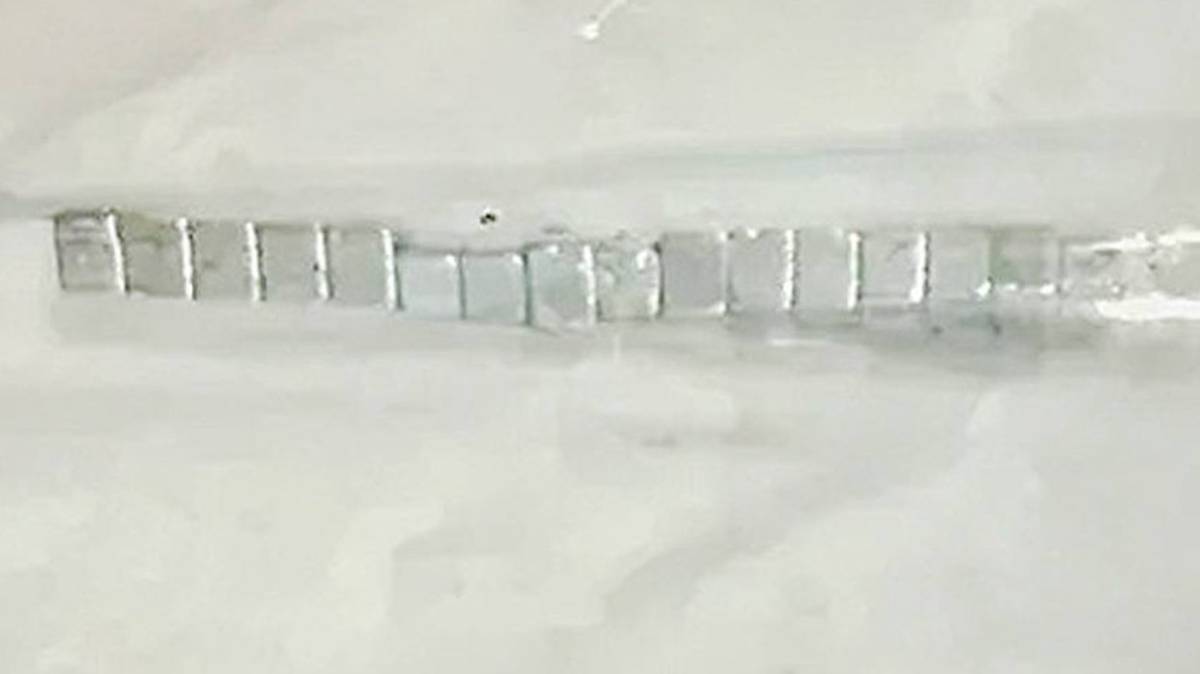 Moscow doctors removed 16 magnets from the nose of a ten-year-old boy