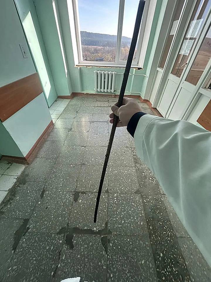 Кировские хирурги спасли мальчика, которому металлический штырь проткнул все тело